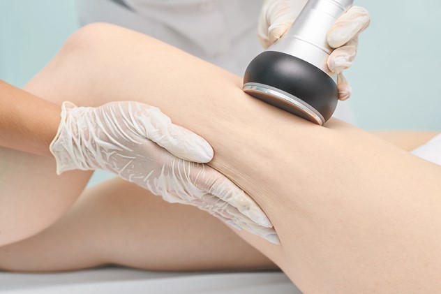 Lipocavitation